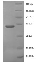 Fungi RPN13 protein