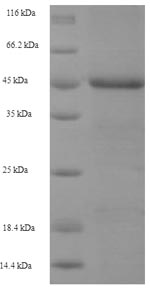 Human NAIP protein
