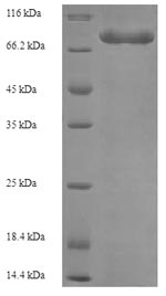 Human ETFDH protein