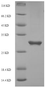 Human PDCD1 protein