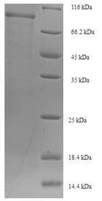 Human SNX1 protein