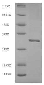 Human ITIH5 protein