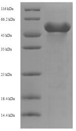 Human AADAT protein