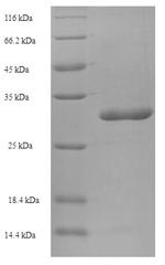 Human SARAF protein