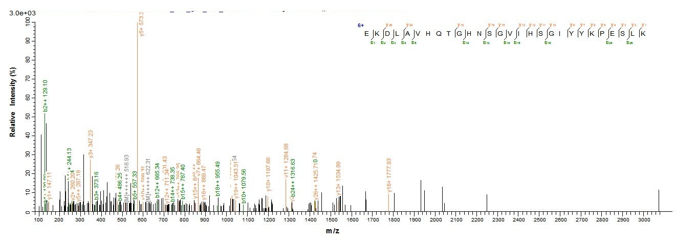 Human L2HGDH protein