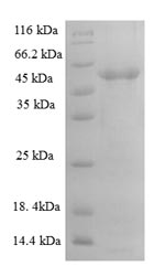 Human ADAMTS7 protein
