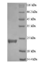 Human CASP5 protein