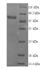 Mouse Cyp2e1 protein