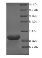 Human GPR75 protein