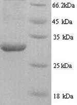 Human HNRNPL protein