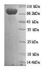 Human MASP1 protein