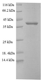 Mouse Pcsk5 protein