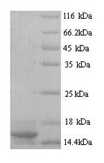 Rat Ptma protein