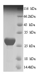 Human SLC26A5 protein