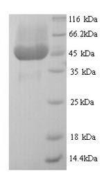 Bacterial Type III protein