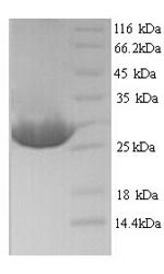 Plant Ribosome-inactivating protein lychnin protein