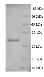 Plant Ribosome-inactivating protein charybdin protein