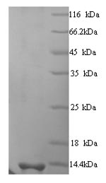 Viral KP6 killer toxin protein