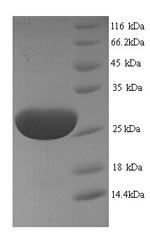 Plant Ribosome-inactivating protein karasurin-C protein