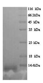 Viral GP protein