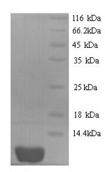 Insect Beta-mammal toxin Cn2 protein