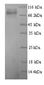 Human GCKR protein