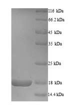 Viral GP protein