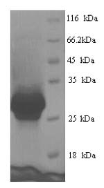 Human CEMP1 protein