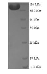 Human MTRR protein