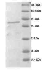 Human ADAMTS7 protein