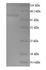 Human FBXO3 protein