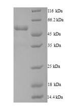 Human DCTN4 protein