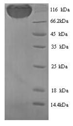 Rat Podxl protein