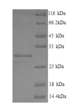 Human LHPP protein