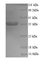 Viral VP30 protein