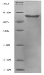 Bovine HNRNPA2B1 protein
