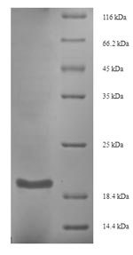 Reptile Omega-hexatoxin-Hv1a protein