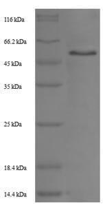 Rat Tpbg protein