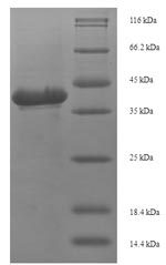 Bacterial TST protein