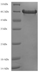 E. coli tig protein