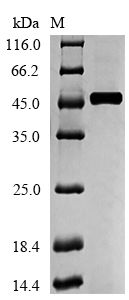 Human ACADM protein