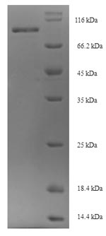 Mouse Osbpl11 protein