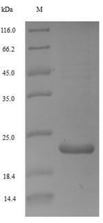 Viral WHV protein