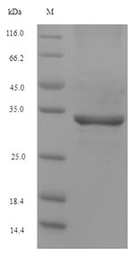 Pig Major pepsin inhibitor 3 protein