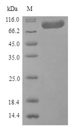 Human F13A1 protein
