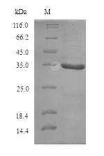 Bacterial pcrA protein
