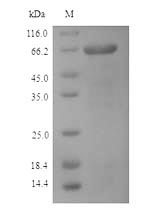 Viral NP protein