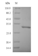 Mouse Nqo1 protein