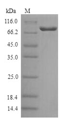 Human GALC protein
