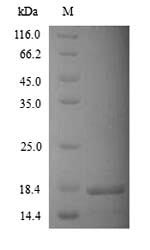 Human KCNK2 protein